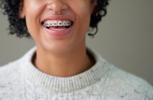 Are Metal Braces Right for You?