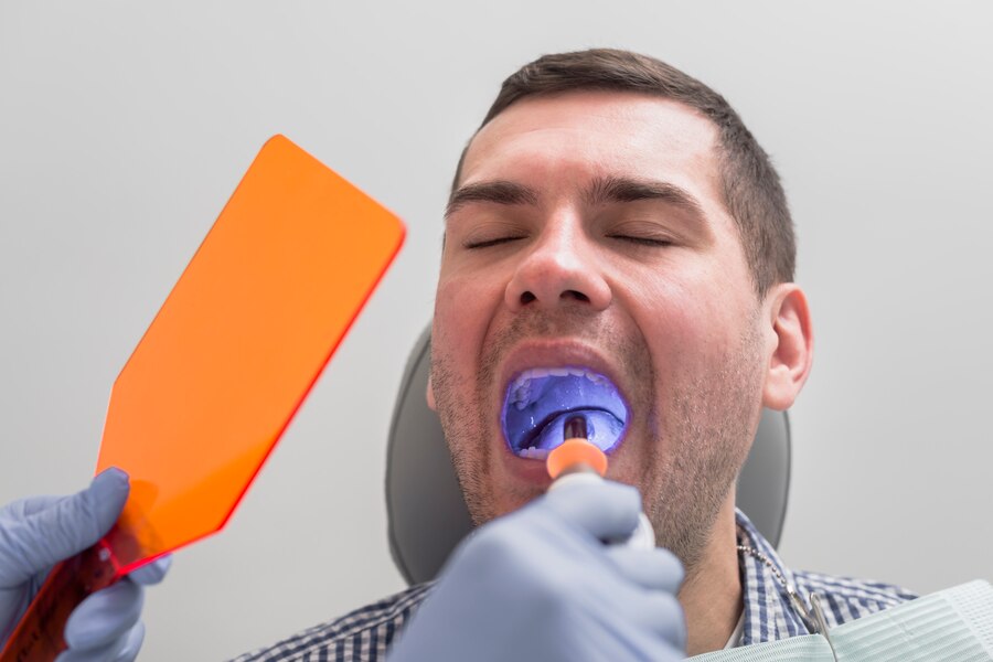 Sealants: A Simple Way to Protect Your Child’s Teeth