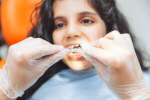 Invisalign braces for kids