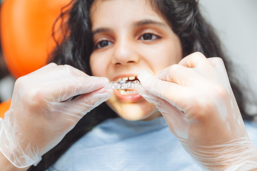 What Age is Best for Invisalign Treatment in Children?