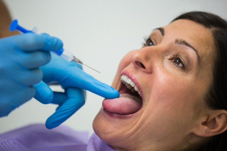 Dental Filling Procedure: Step-by-Step Guide and What to Expect