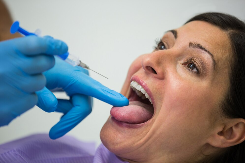 Dental Filling Procedure: Step-by-Step Guide and What to Expect