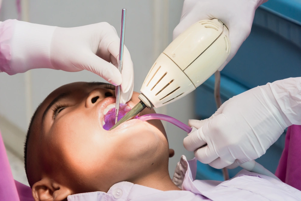 A Complete Guide to Children’s Dental Cleaning 