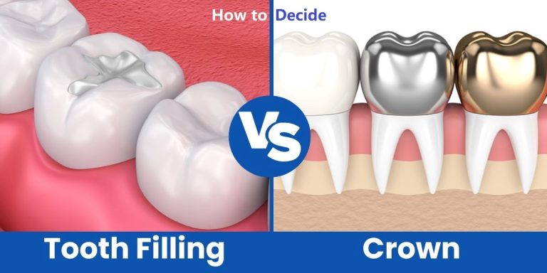 How to Decide Between a Dental Crown vs Filling for Damaged Teeth