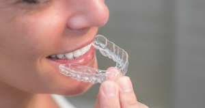 How Long Do You Have To Wear A Retainer After Braces?