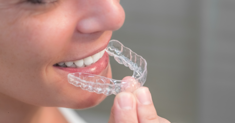 How to Handle Orthodontic Emergencies in Tampa?