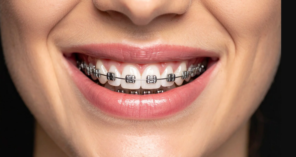 Problems an Early Orthodontic Check Can Find