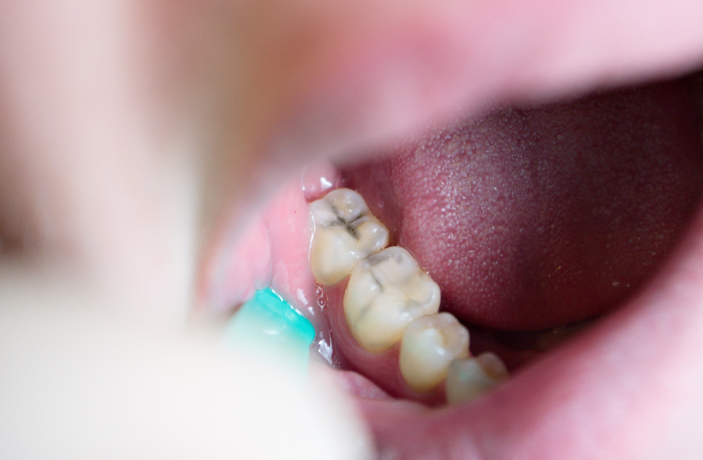 How Can a Child’s Diet Affect Their Risk of Cavities?